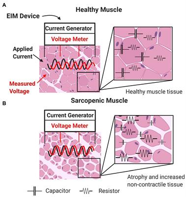 Potential Utility of Electrical Impedance Myography in Evaluating Age-Related Skeletal Muscle Function Deficits